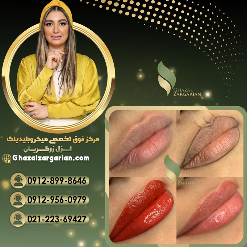 قیمت تاتو لب مرکز میکروبلیدینگ غزل زرکیان 