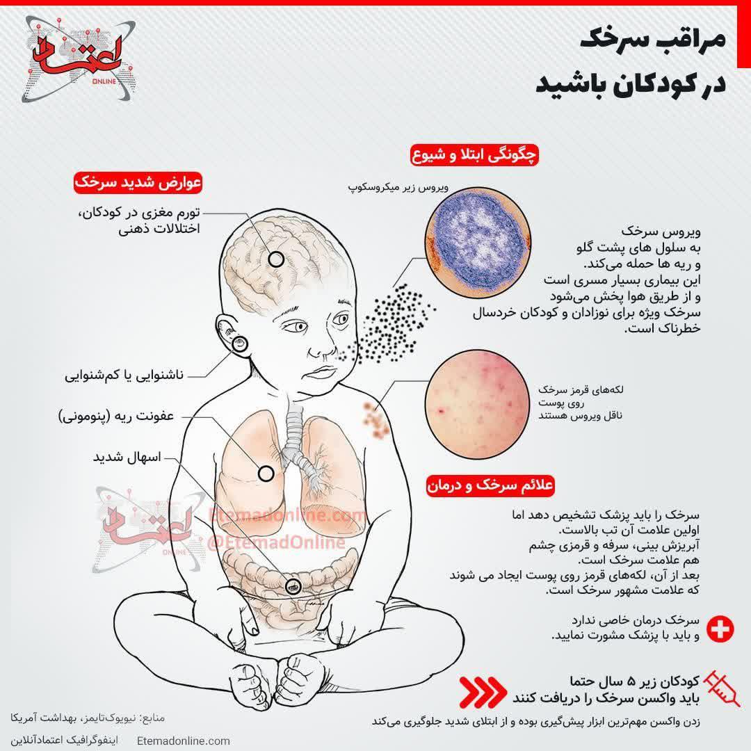 https://s6.uupload.ir/files/%D9%85%D8%B1%D8%A7%D9%82%D8%A8_p89r.jpg