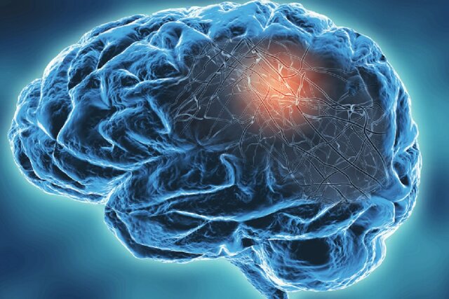 ابتلای شدید به کرونا مغز را ۲۰ سال پیر می‌کند