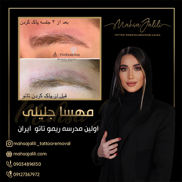 ریم تاتو ابرو 
