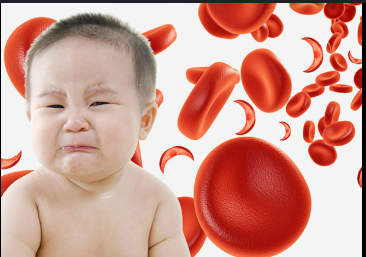 کم‌خونی در کودکان | علائم، علت‌ها، درمان و پیشگیری