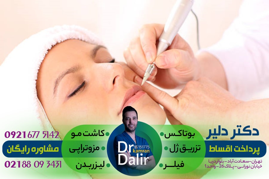 تزریق ژل بوتاکس برای کاهش چین و چروک بینی