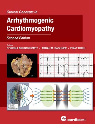 Current Concepts in Arrhythmogenic Cardiomyopathy