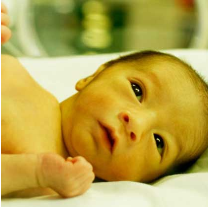 زردی نوزادان: علائم، علل، درمان و خطرات