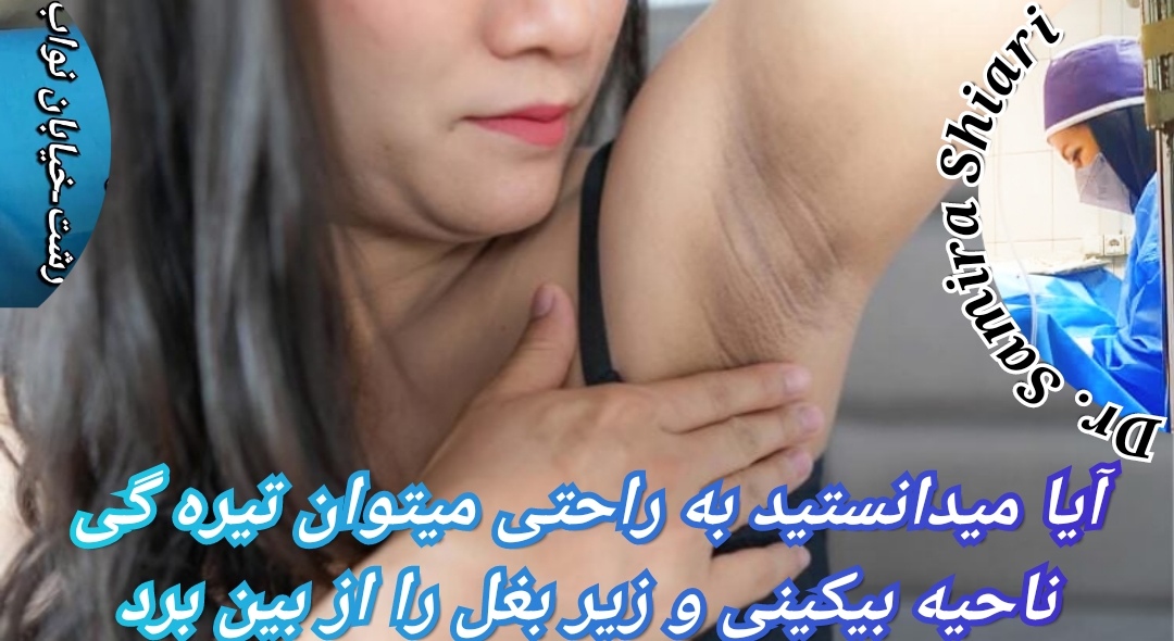 دکتر زنان در رشت برای سفید کردن بیکینی