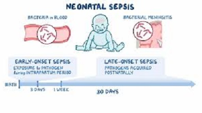 سپسیس نوزادی: علائم، علل، تشخیص و درمان