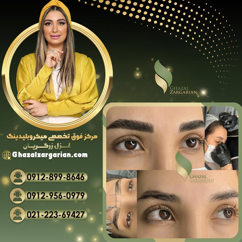 آموزش میکروبلیدینگ ابرو با بهترین تکنیک