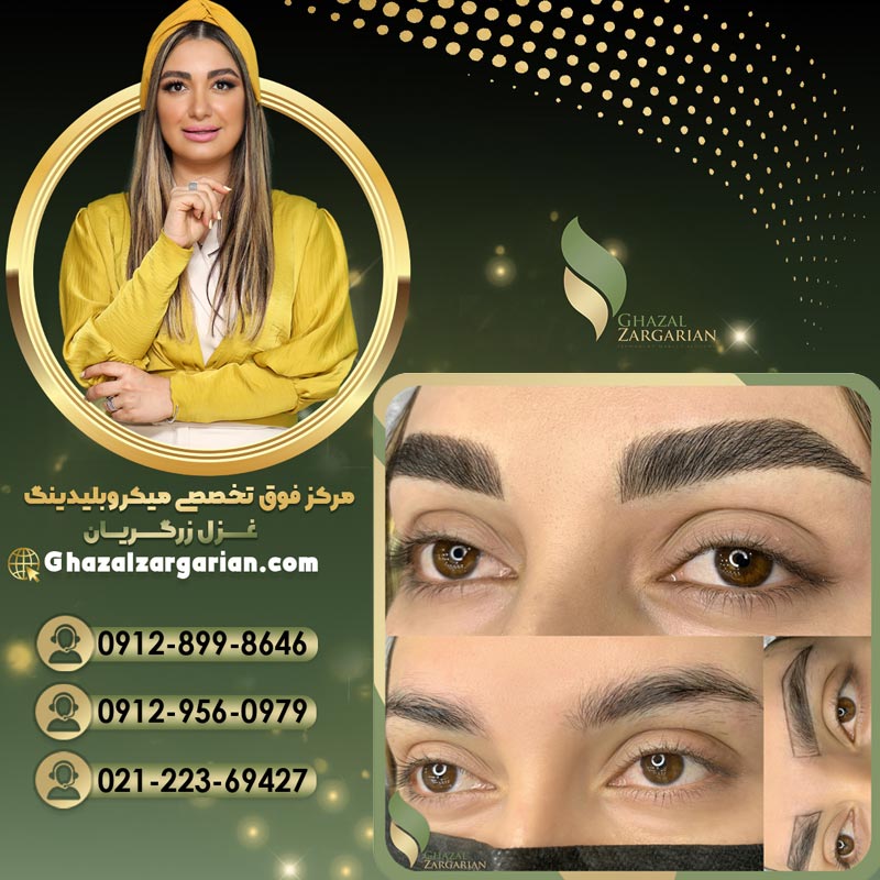 آموزش میکروبلیدینگ ابرو بدون عوارض