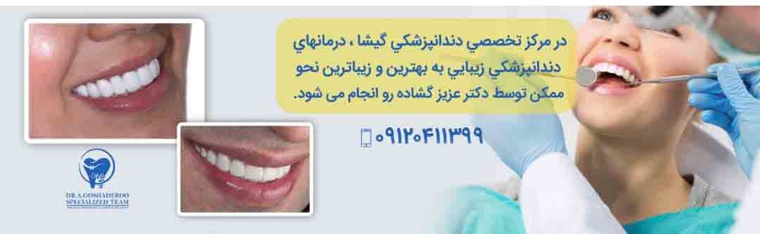چگونه بهترین دندانپزشک زیبایی در تهران انتخاب کنیم