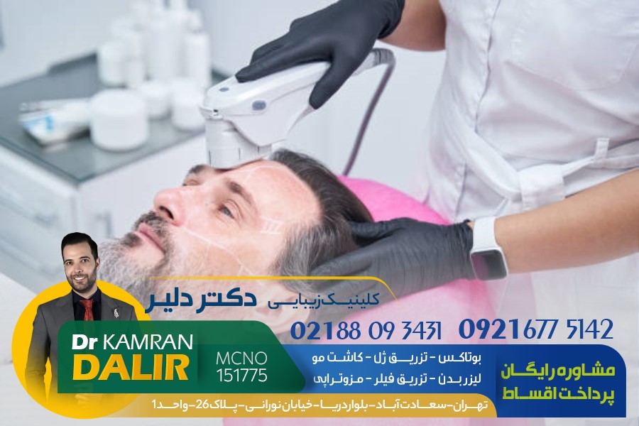 کاشت مو با پرداخت اقساط، با روش نقطه‌ای